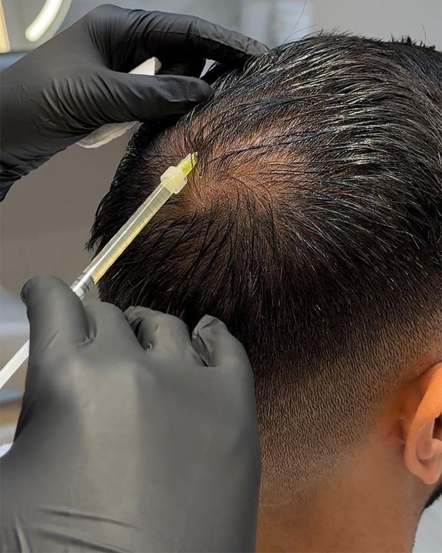 PRP Therapy